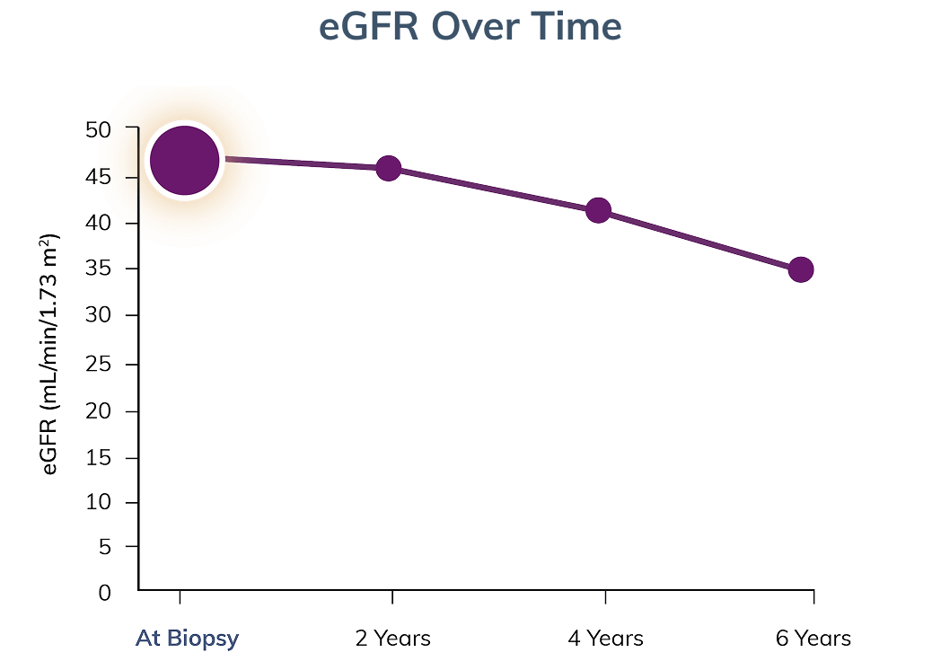 Graph modeling eGFR decline over time, starting at biopsy