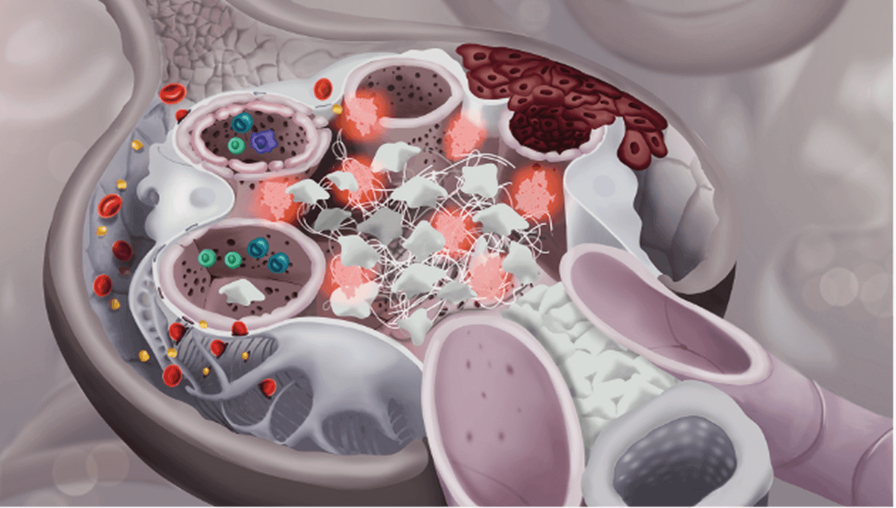 Kidney structure showing glomerulosclerosis and tubular atrophy